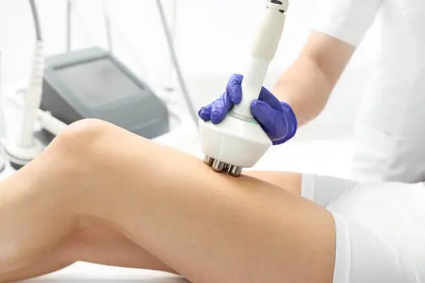 Tratamento de estria