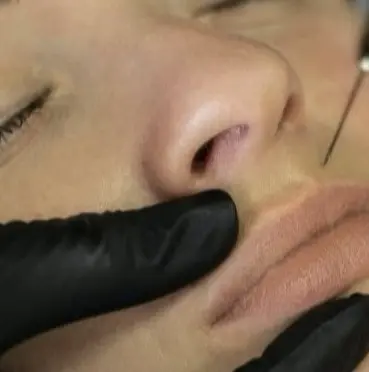 preenchimento labial